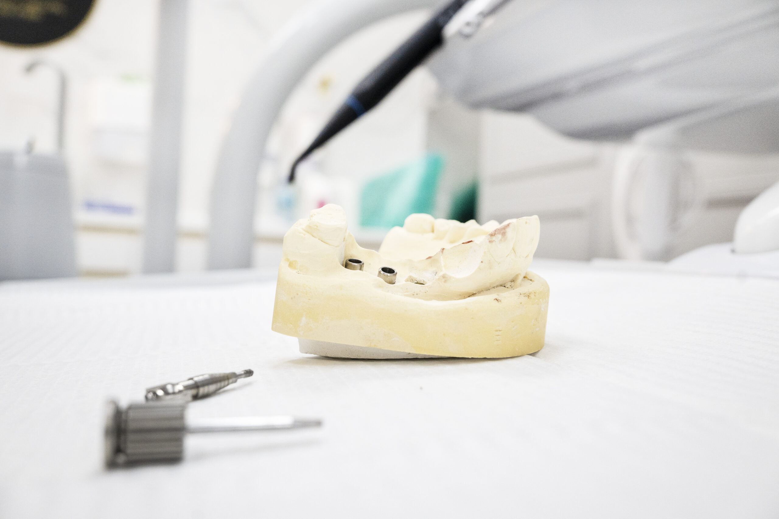 Periimplantitis – przyczyny, objawy i leczenie zapalenia wokół implantu